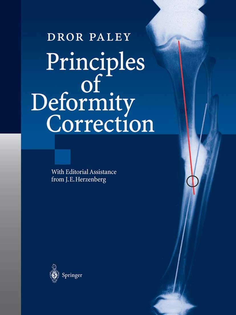 語学・辞書・学習参考書 principles of deformity correction Principles of Deformity Correction 2003 Edition by Paley, Dror